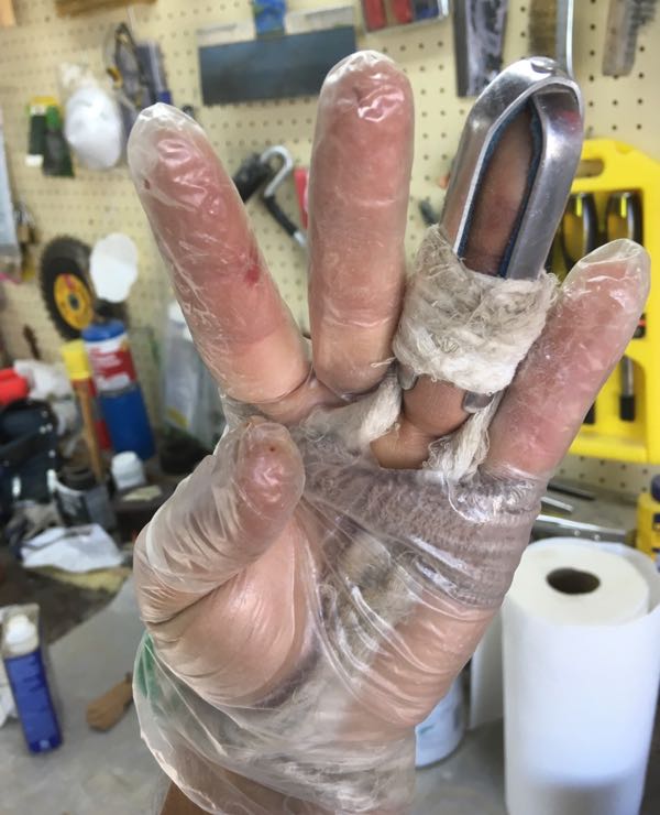 Broken Finger